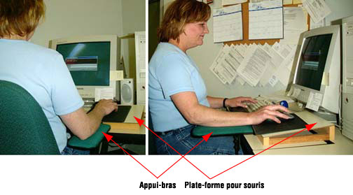 Figure 3 - Support pour l'avant-bras